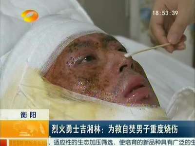 烈火勇士吉湘林：为救自焚男子重度烧伤
