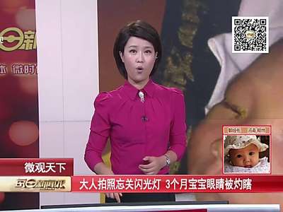 [视频]大人拍照忘关闪光灯 3个月宝宝眼睛被灼瞎