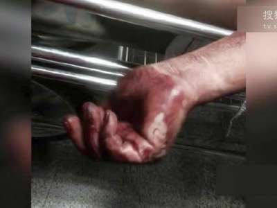 [视频]河南网友称在山东日照吃海鲜被老板扒衣殴打