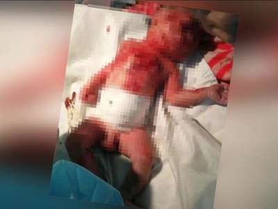 [视频]15岁女孩产子后用竹签将其刺伤 男婴已死亡 