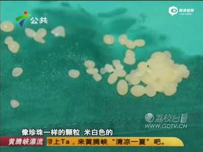 [视频]男子5年前手部受伤 近日长出千颗“珍珠”