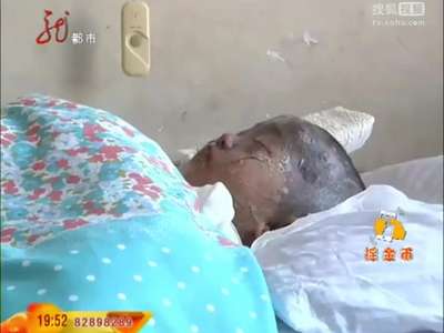 [视频]3岁女童跌入麻辣烫热锅 全身烫伤超50