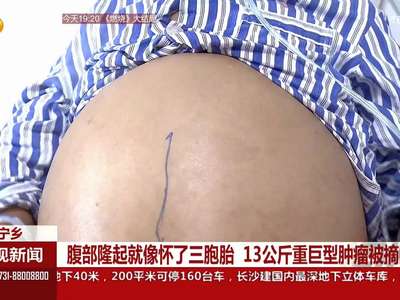 宁乡：腹部隆起就像怀了三胞胎 13公斤重巨型肿瘤被摘除