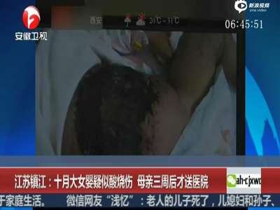 [视频]十月大女婴遭大面积烧伤 母亲支支吾吾不说原因