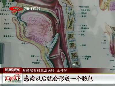 [视频]成都：女子误吞鱼刺致离世 卡刺处理方法存误区