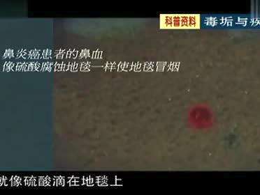 科普专题-毒垢与疾病